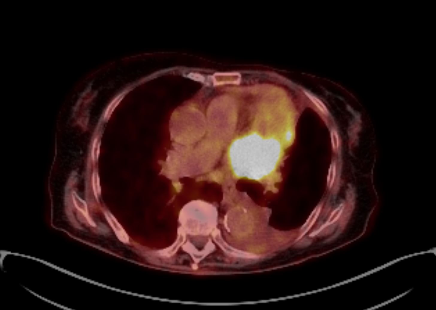 PET/CT - Das Radiologie Team