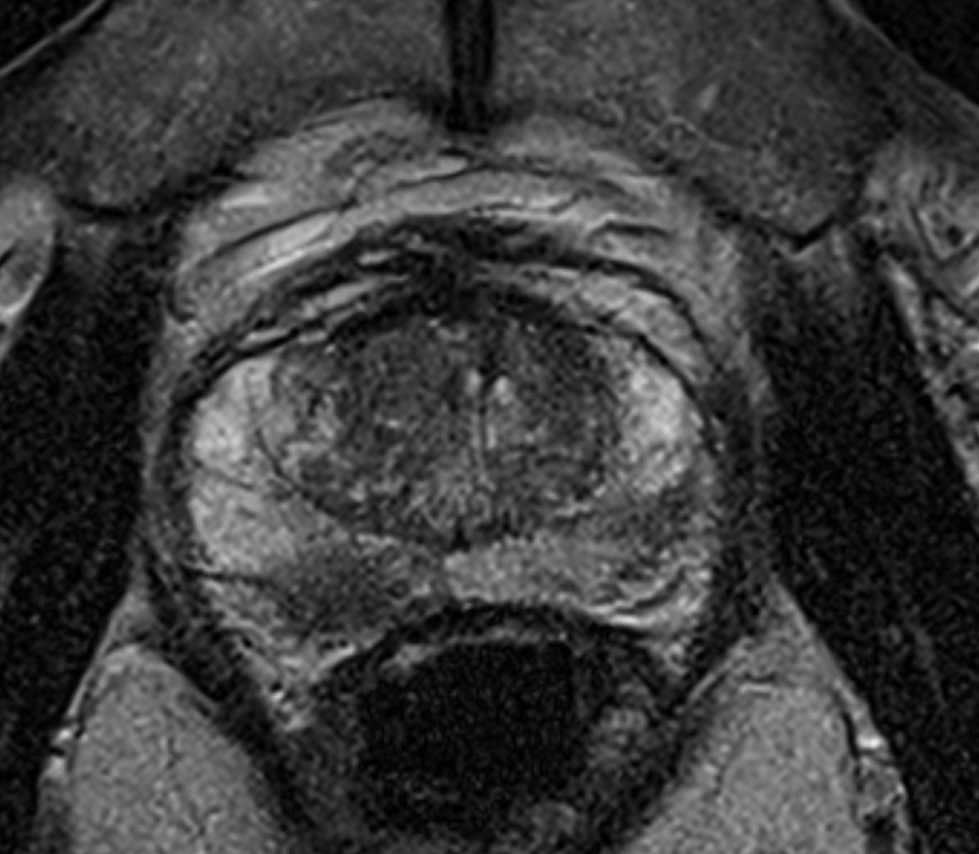 mrt-1b-das-radiologie-team